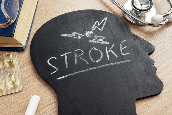 Apa yang Anda Perlu Tahu Tentang Strok?